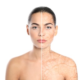 Image of Dry skin treatment. Beautiful young woman before and after procedure on white background, collage