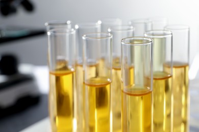 Photo of Tubes with urine samples for analysis in laboratory, closeup