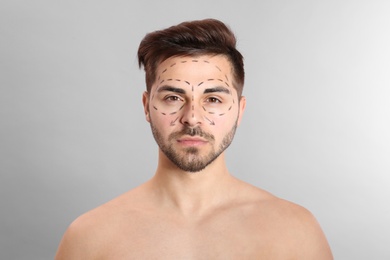 Photo of Young man with marks on face for cosmetic surgery operation against grey background