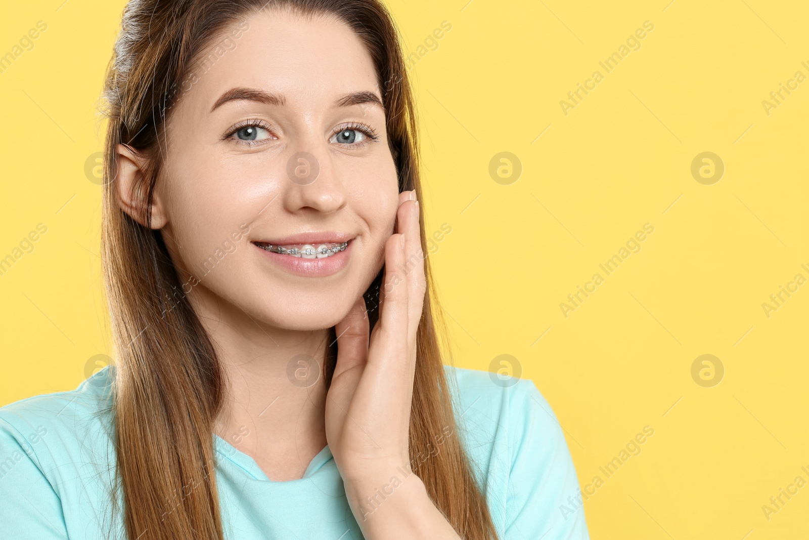 Photo of Portrait of smiling woman with dental braces on yellow background. Space for text