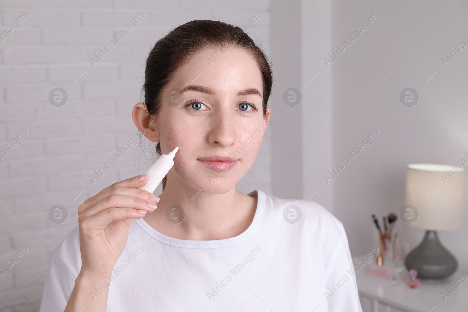 Photo of Woman with acne problem applying cream at home