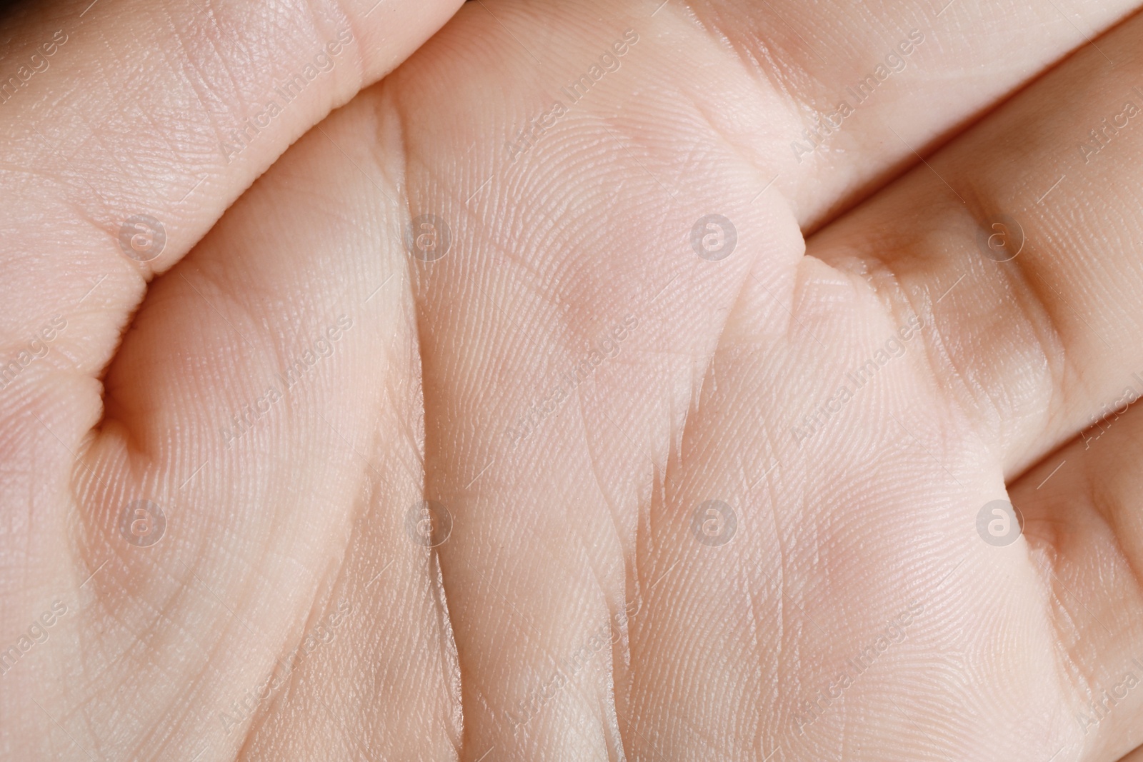 Photo of Closeup view of human hand with dry skin