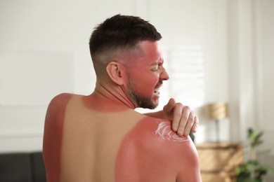 Photo of Man applying cream on sunburn at home, back view