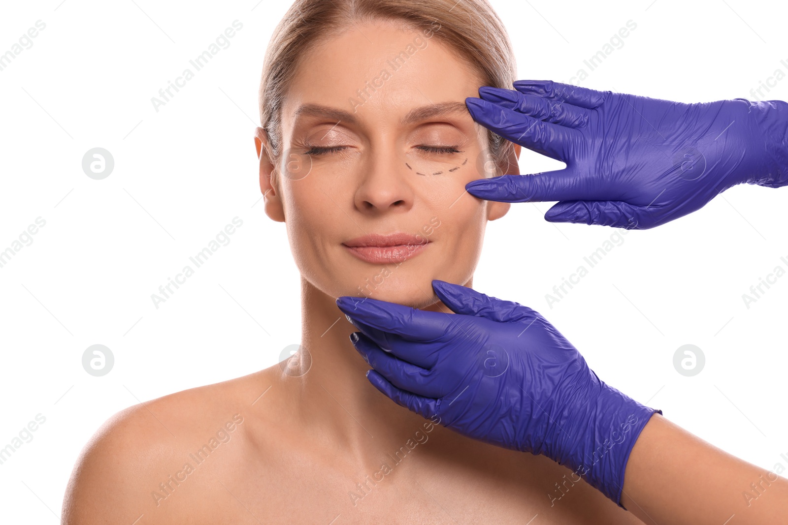 Photo of Doctor checking patient's face before cosmetic surgery operation on white background, closeup