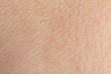 Photo of Texture of dry skin as background, macro view