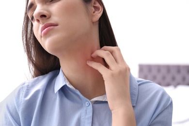 Photo of Young woman scratching neck indoors, closeup. Allergies symptoms