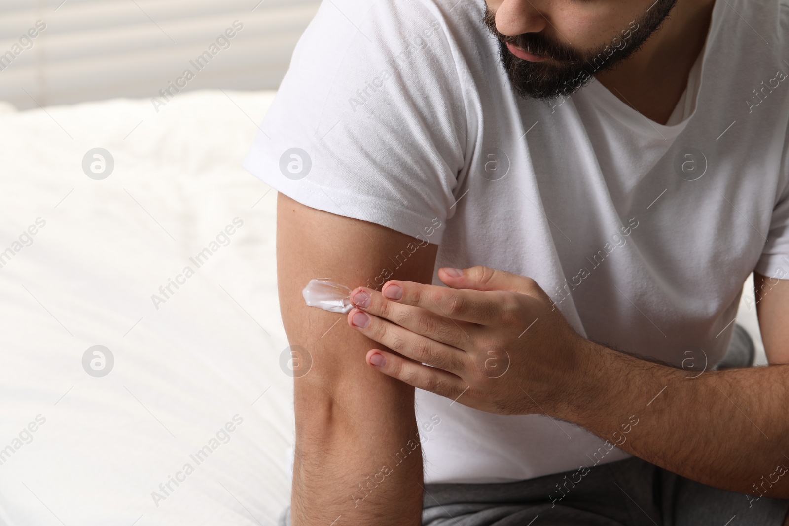 Photo of Man with dry skin applying cream onto his arm on bed, closeup. Space for text