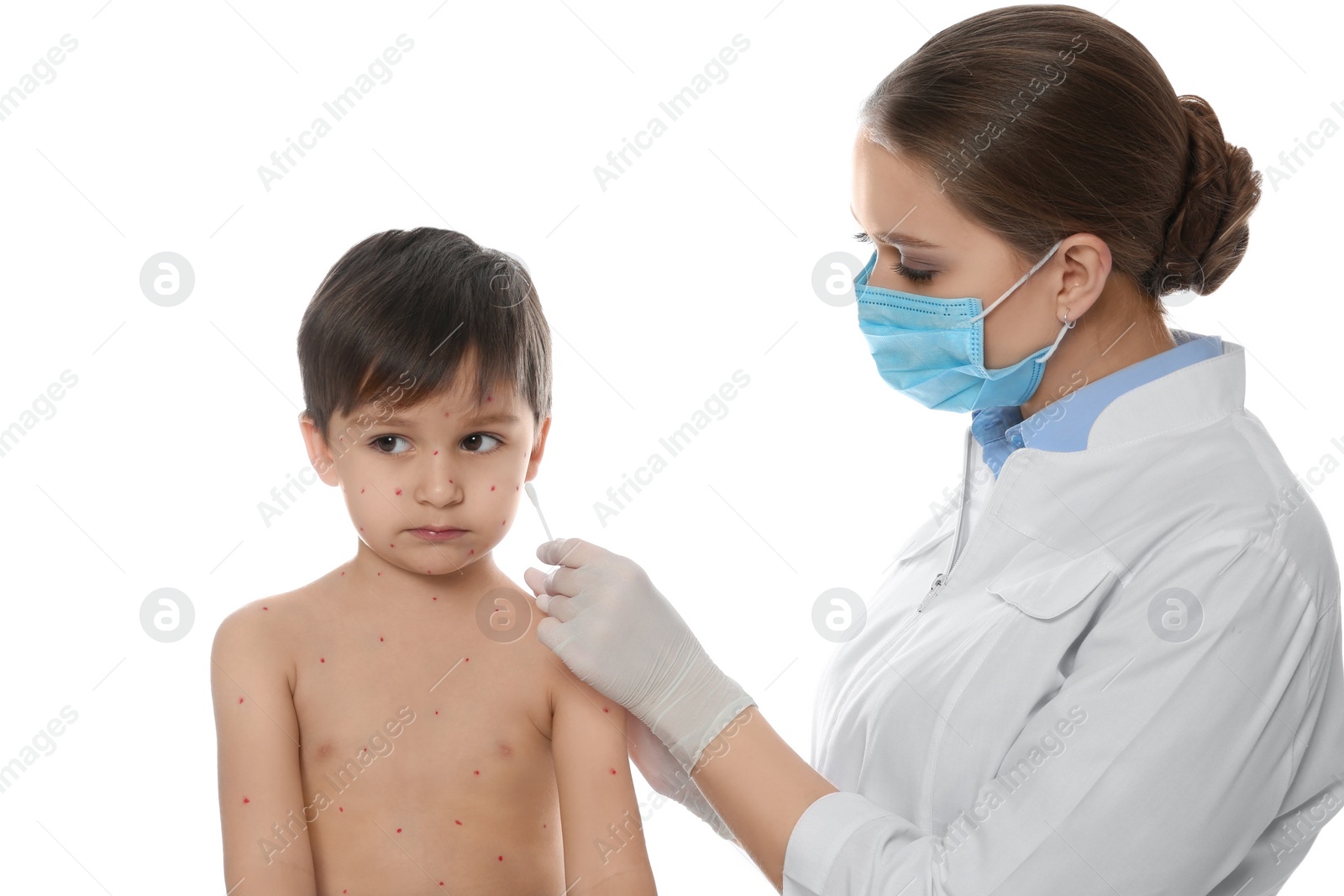 Photo of Doctor applying cream onto skin of little boy with chickenpox against white background. Varicella zoster virus