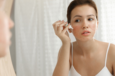 Photo of Teen girl with acne problem applying cream near mirror in bathroom