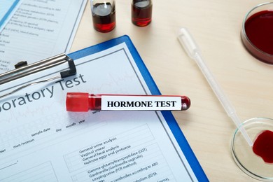 Photo of Hormone test. Sample tube with blood and laboratory form on table