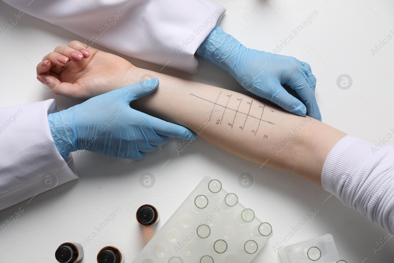 Photo of Doctor doing skin allergy test at light table, top view