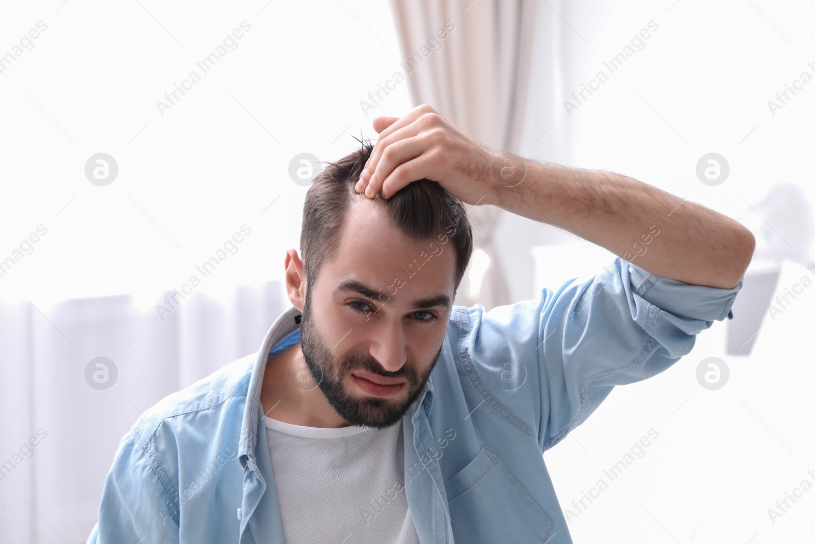 Photo of Young man with hair loss problem indoors