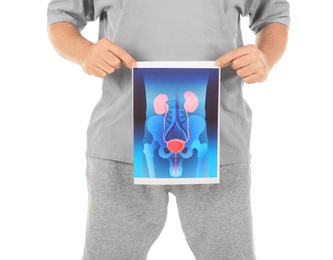 Photo of Mature man holding picture of urinary system on white background