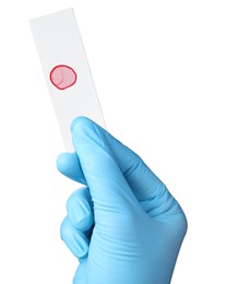 Scientist holding microscope slide with sample on white background, closeup