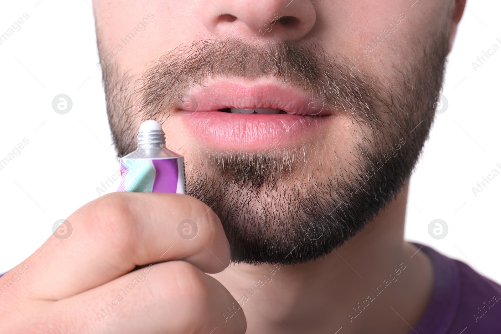 Photo of Young man applying cold sore cream on lips against white background, closeup