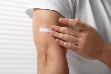 Photo of Man with dry skin applying cream onto his arm indoors, closeup
