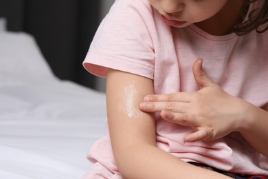 Little girl applying ointment onto her arm at home, closeup