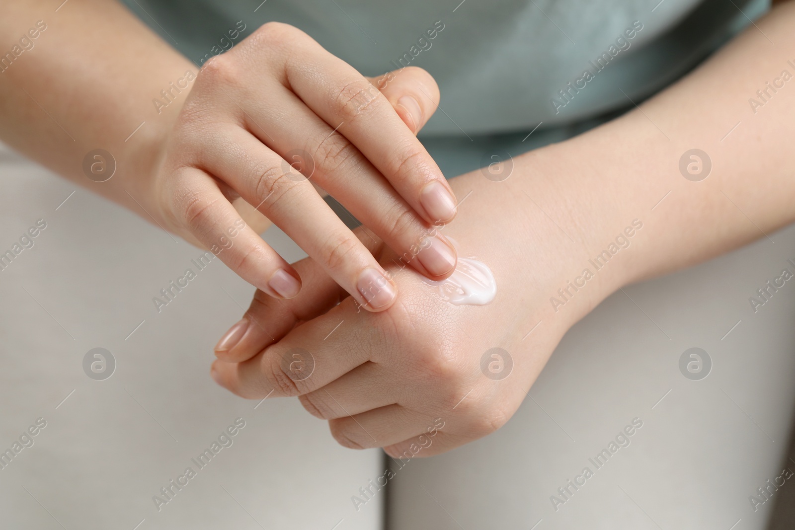 Photo of Woman applying ointment onto her hand, closeup