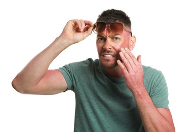 Man with sunburned skin on white background