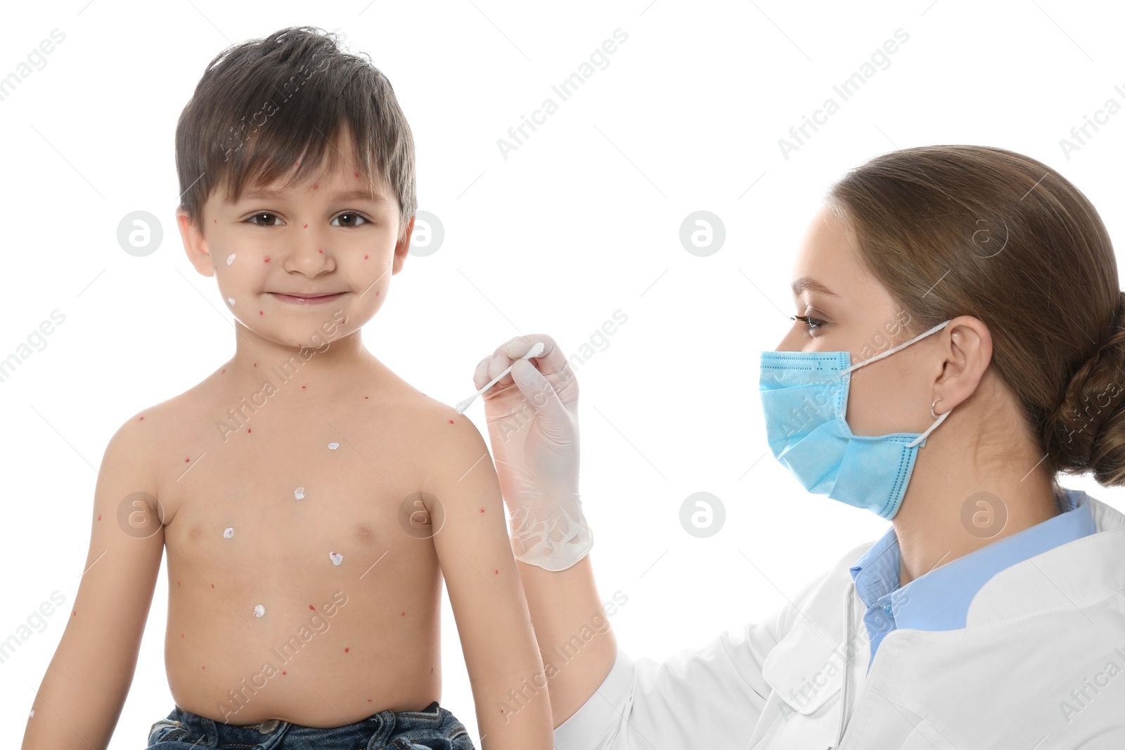 Photo of Doctor applying cream onto skin of little boy with chickenpox against white background. Varicella zoster virus