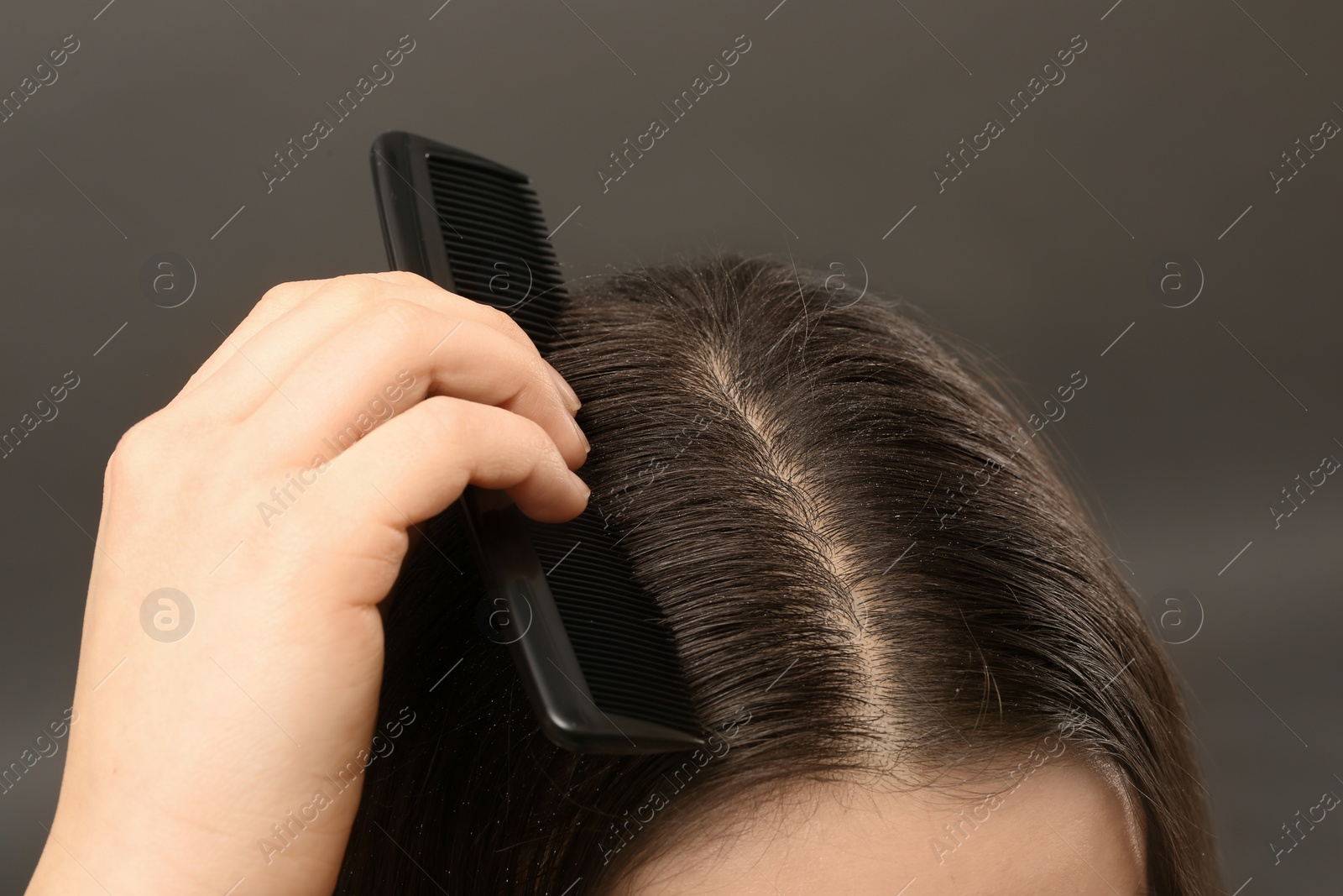 Photo of Woman with comb and dandruff in her dark hair on grey background, closeup