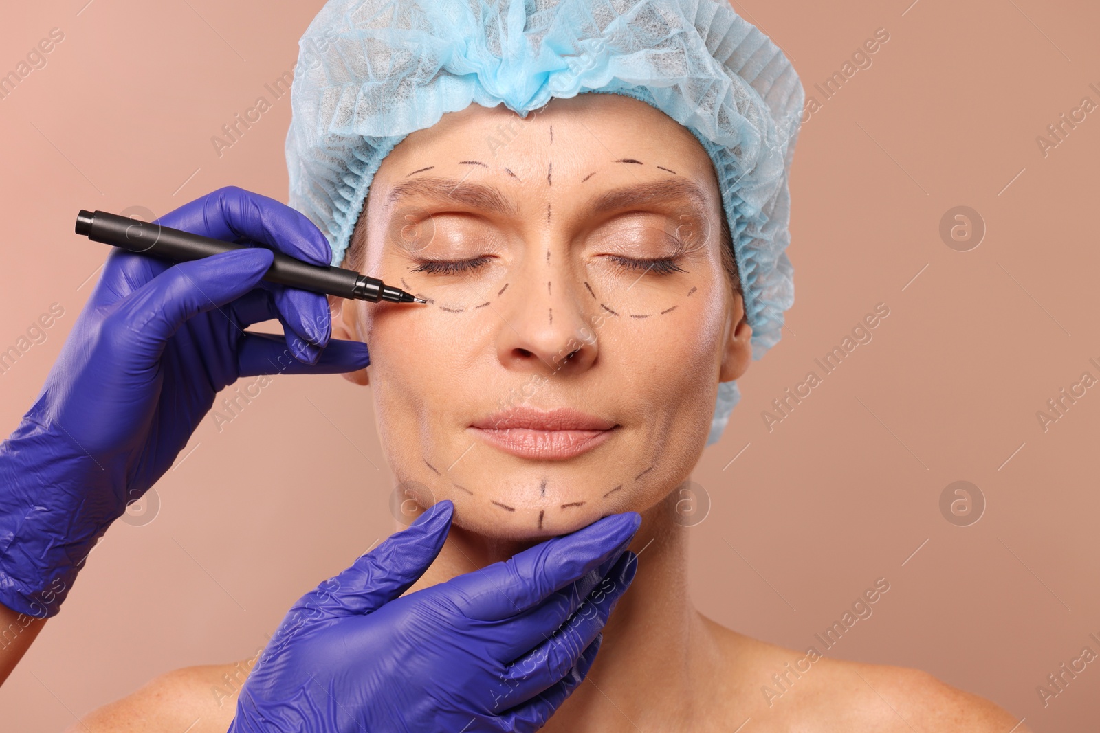 Photo of Doctor with marker preparing patient for cosmetic surgery operation on light brown background, closeup