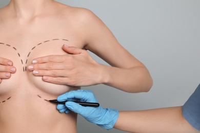 Doctor drawing marks on female breast for cosmetic surgery operation against color background