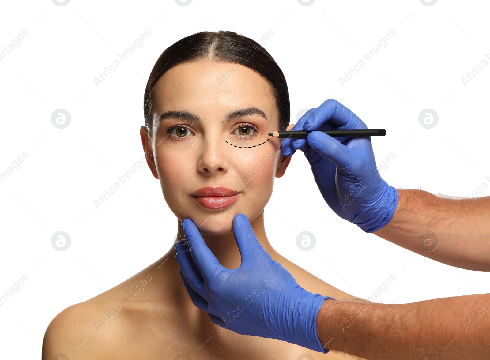 Image of Woman preparing for cosmetic surgery, white background. Doctor drawing markings on her face, closeup
