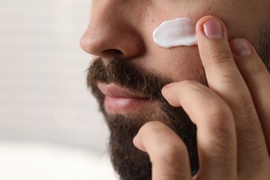 Photo of Man with dry skin applying cream onto his face on light background, closeup. Space for text