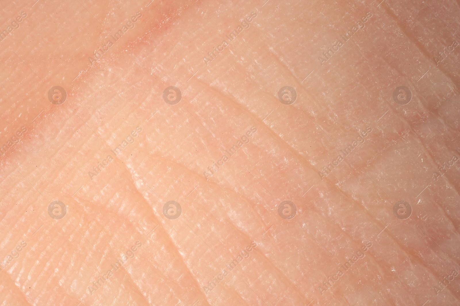 Photo of Texture of dry skin as background, macro view