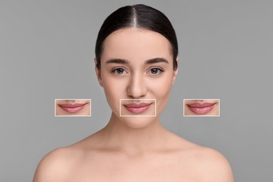 Image of Attractive woman with beautiful lips on grey background. Zoomed areas showing difference in lip fullness due to cosmetic procedure