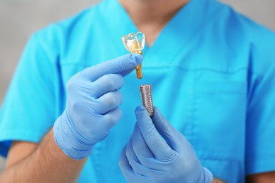 Photo of Dentist holding educational model of dental implant on blurred background, closeup