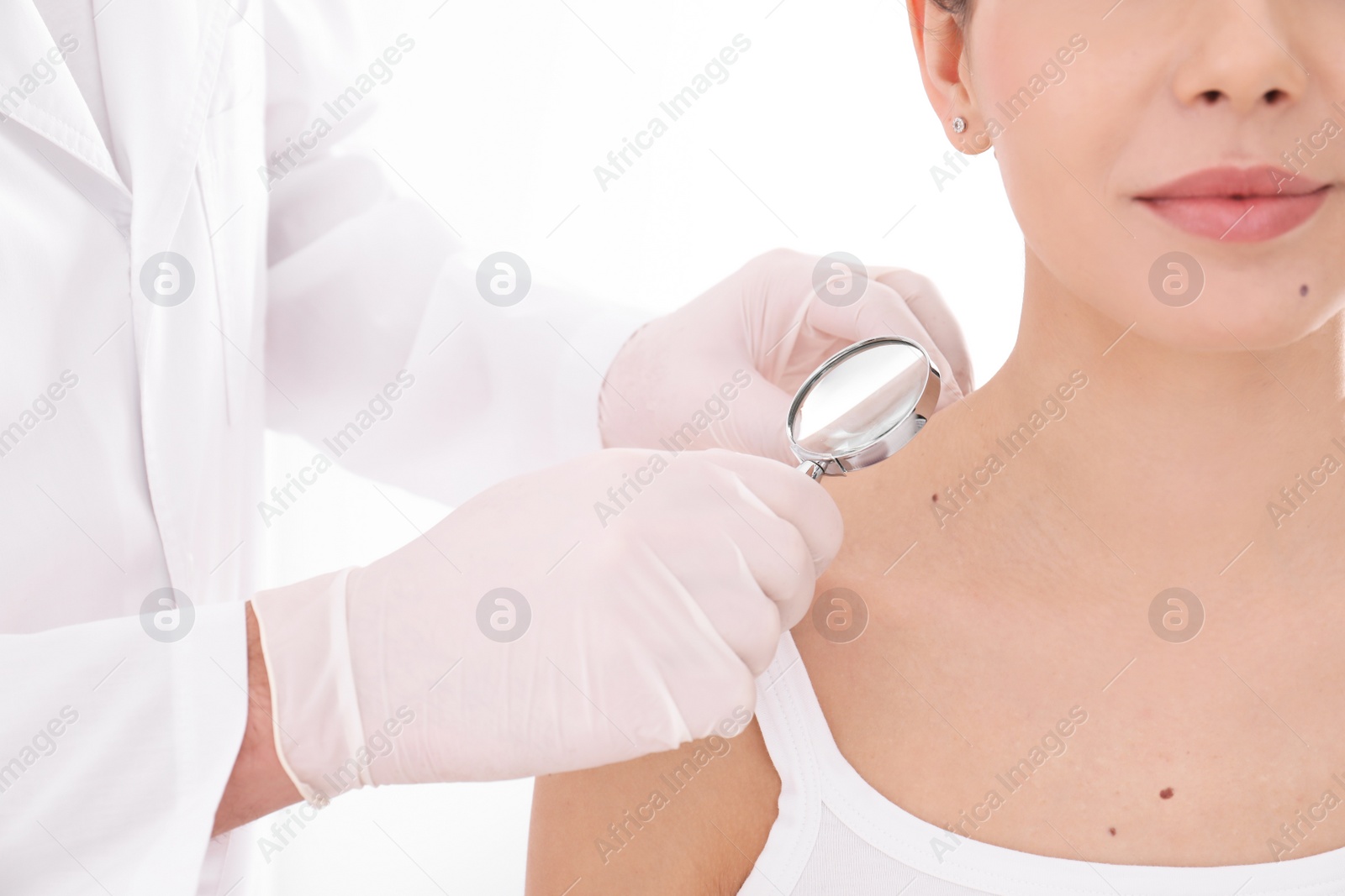 Photo of Dermatologist examining patient with magnifying glass in clinic, closeup view