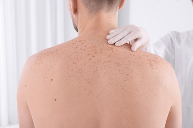 Photo of Doctor examining patient in clinic, closeup view. Visiting dermatologist