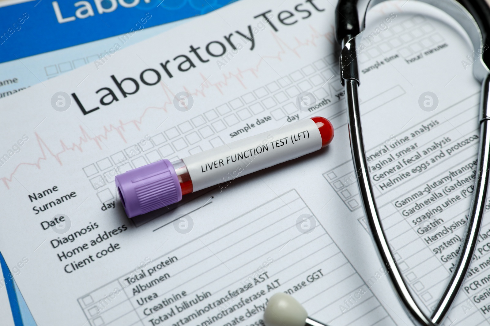 Photo of Liver Function Test. Tube with blood sample and stethoscope on laboratory forms