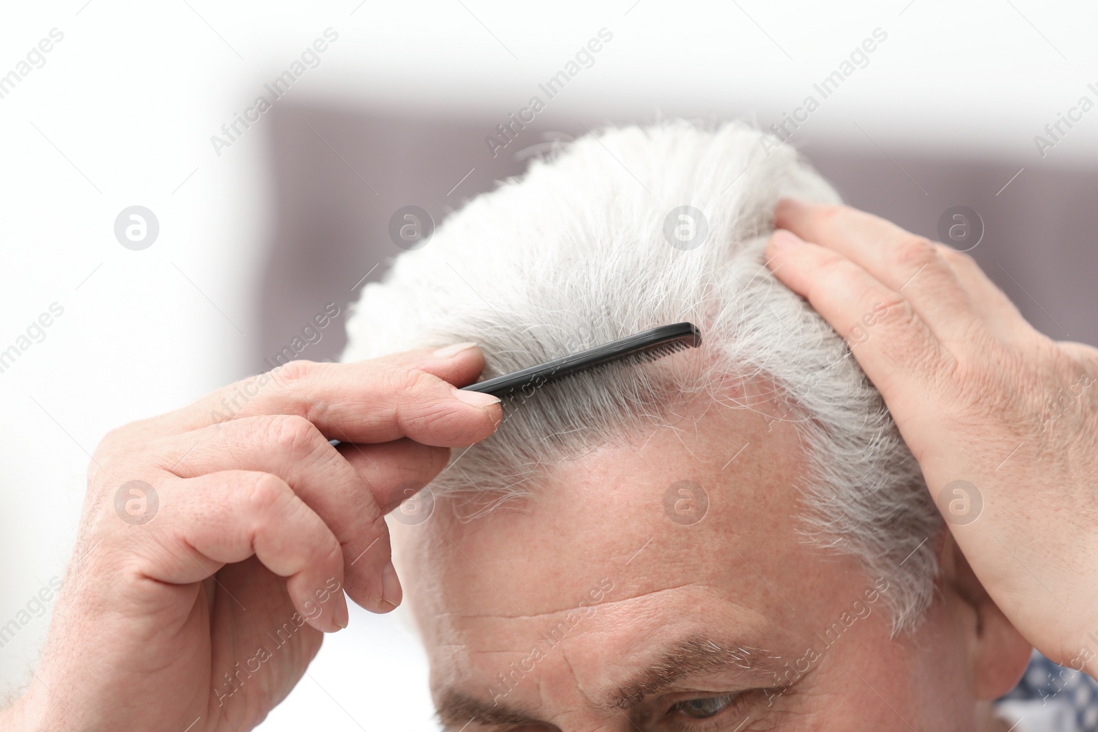 Photo of Senior man with hair loss problem indoors, closeup