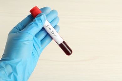 Photo of Scientist holding tube with blood sample and label STD Test on white background, closeup. Space for text