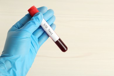 Scientist holding tube with blood sample and label STD Test on white background, closeup. Space for text