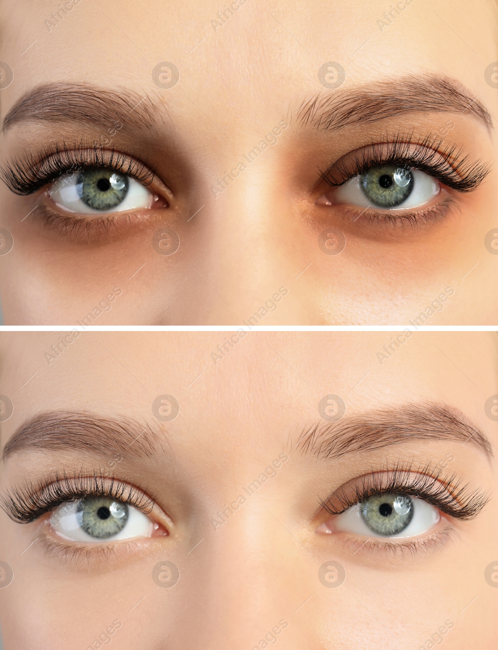 Image of Collage with photos of tired woman with dark circle under eye and after rest, closeup