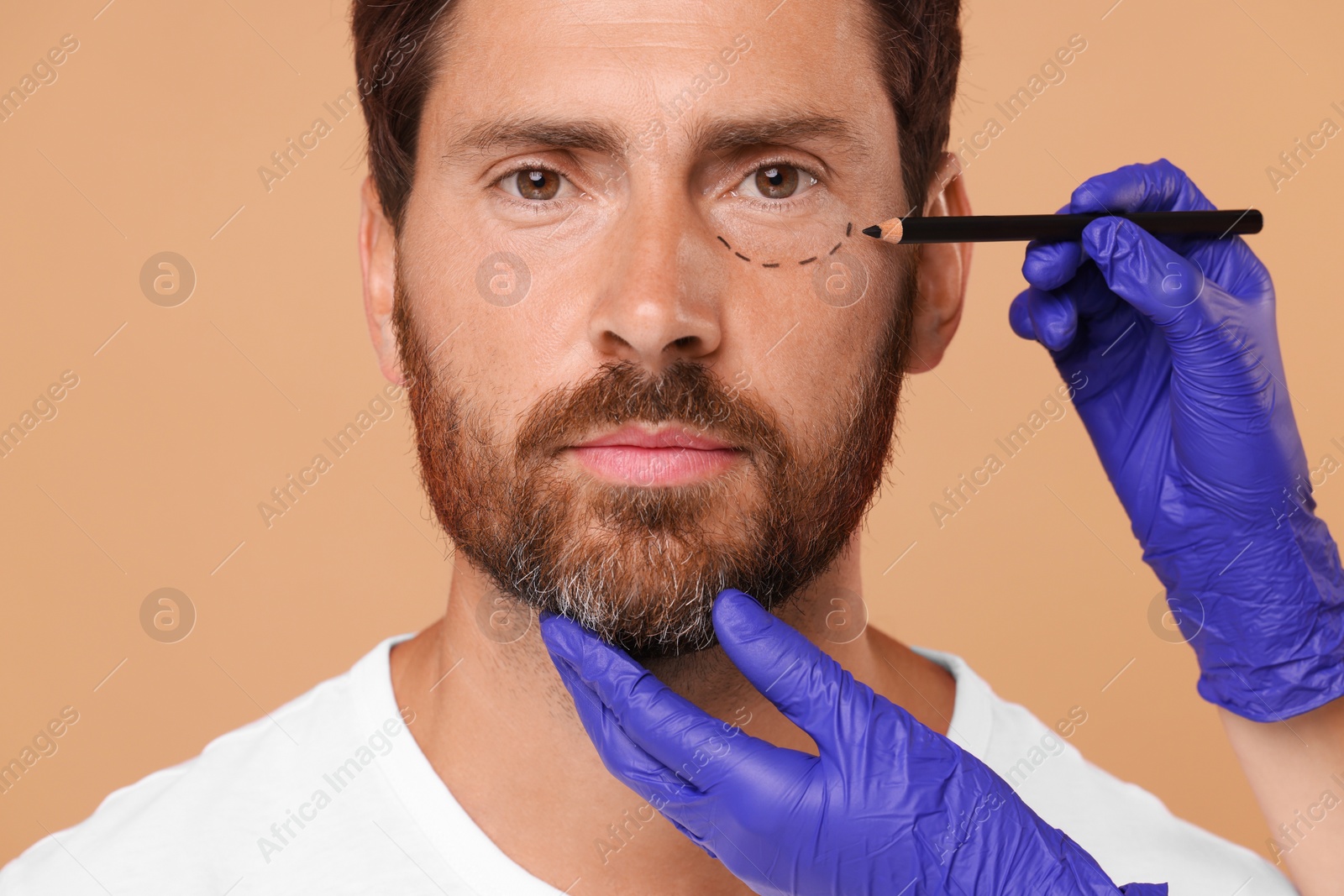 Photo of Doctor drawing marks on man's face for cosmetic surgery operation against beige background