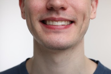 Photo of Young man using whitening strip on light background, closeup