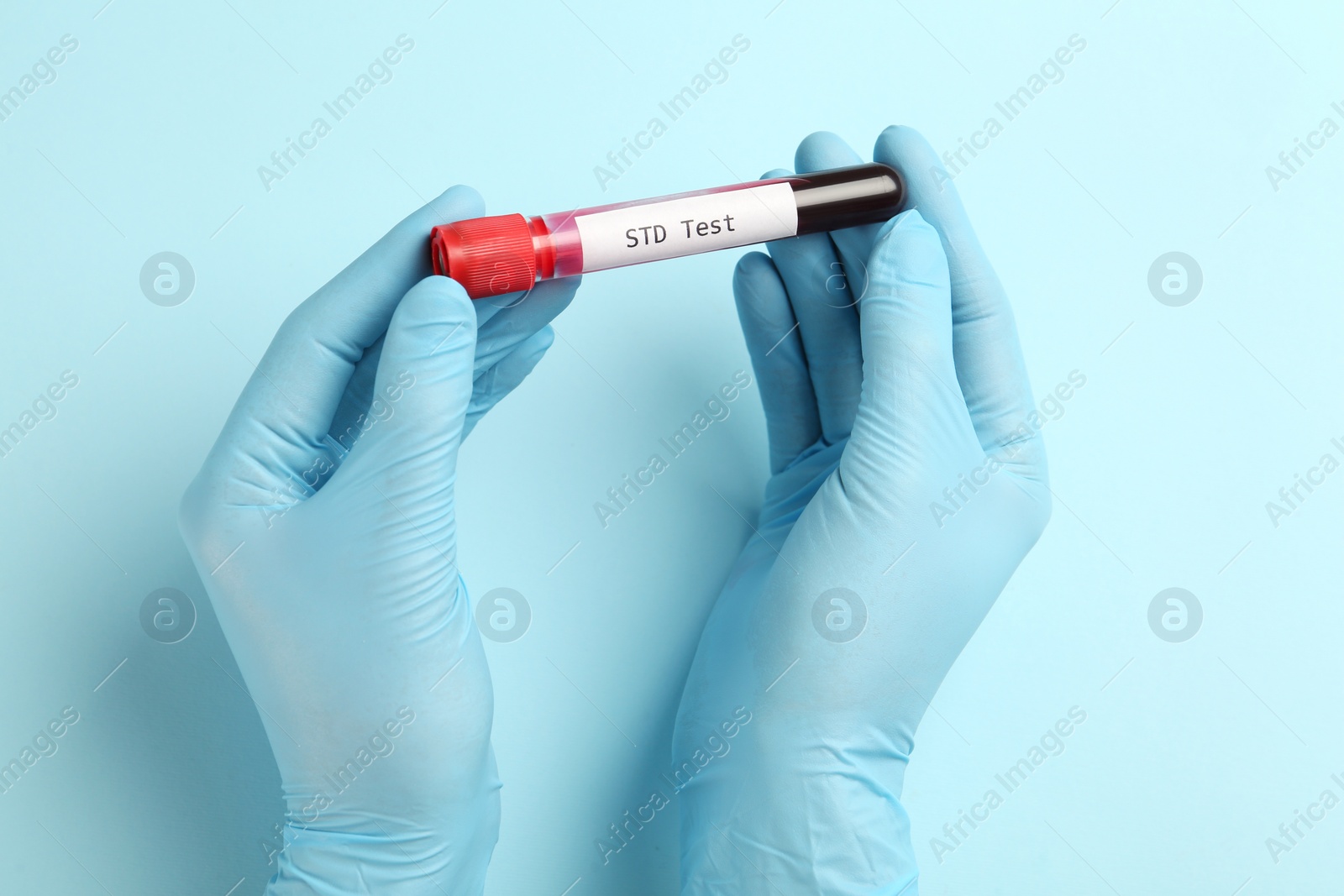 Photo of Scientist holding tube with blood sample and label STD Test on light blue background, top view