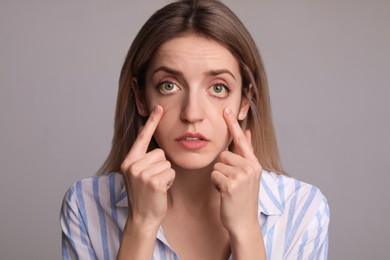 Photo of Woman checking her health condition on grey background. Yellow eyes as symptom of problems with liver