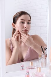 Woman with acne problem near mirror indoors