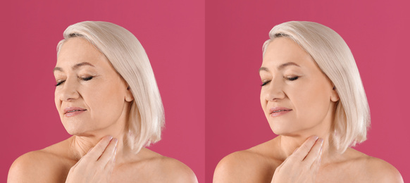 Image of Mature woman before and after cosmetic procedure on pink background 