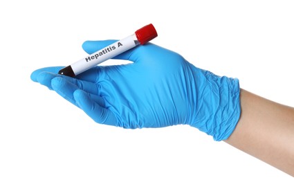 Scientist holding tube with blood sample and label Hepatitis A on white background, closeup