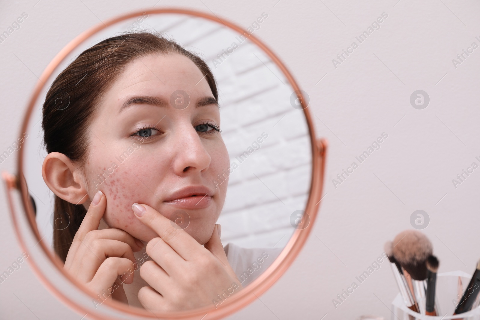 Photo of Woman with acne problem looking at mirror indoors