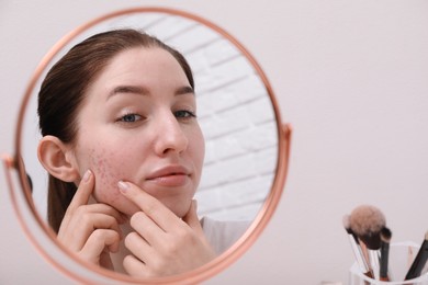 Woman with acne problem looking at mirror indoors