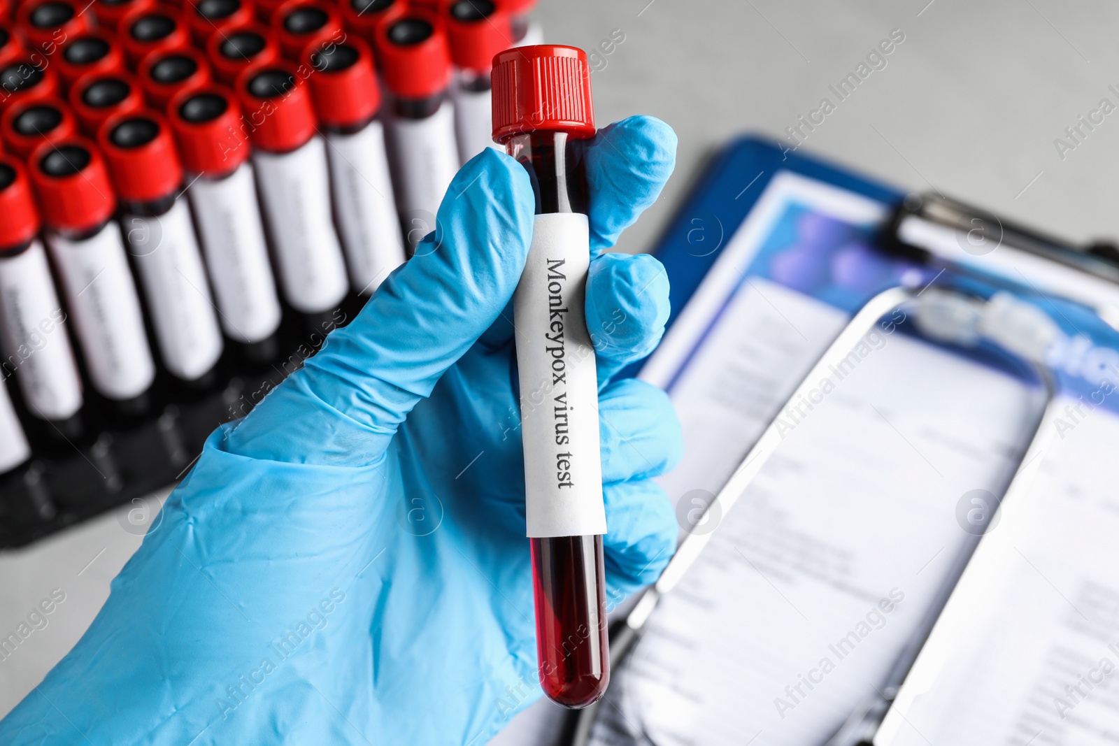 Photo of Monkeypox virus test. Laboratory worker holding sample tube with blood over table, closeup
