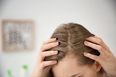 Photo of Young woman with hair loss problem indoors